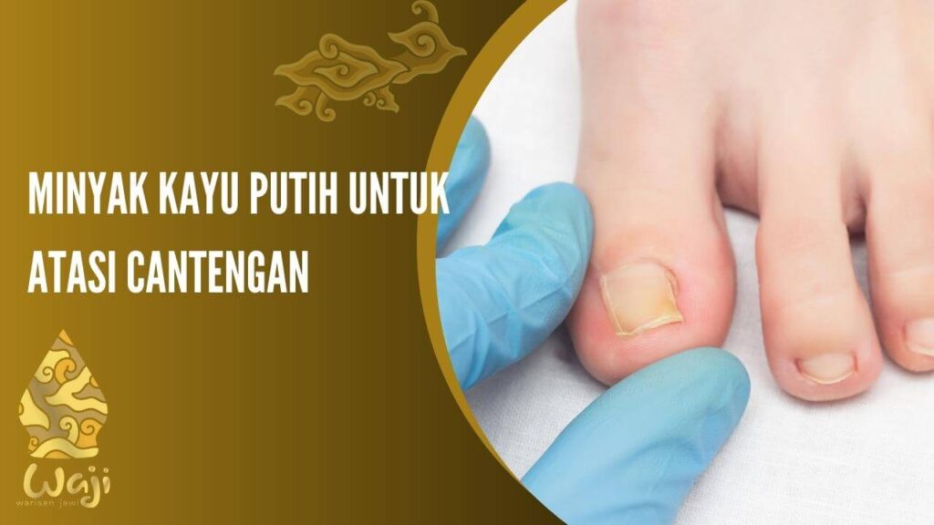 cara mengobati cantengan dengan minyak kayu putih