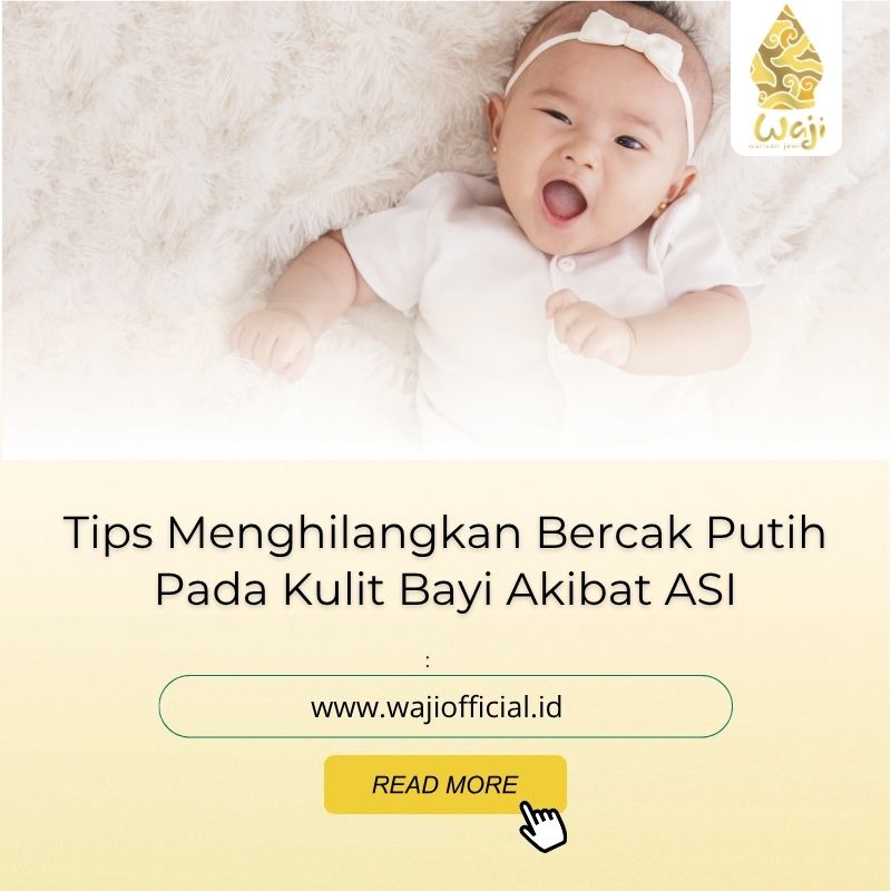 Cara Menghilangkan Bercak Putih di Kulit Bayi Akibat Asi