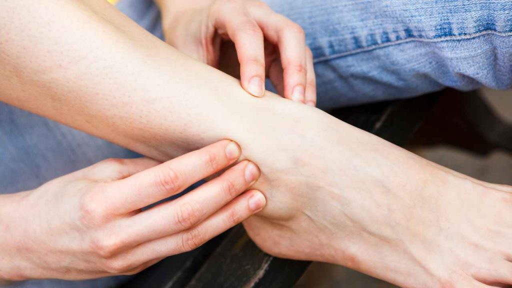 cara mengobati kaki bengkak karena keseleo