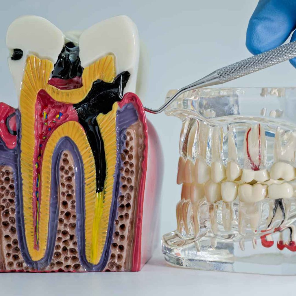 Cara Menenangkan Saraf Gigi yang Sakit