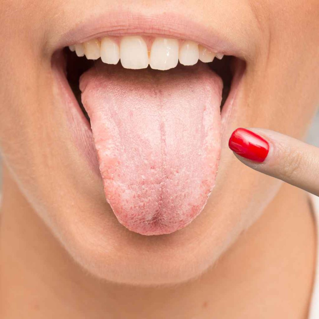 tanda mulut sehat