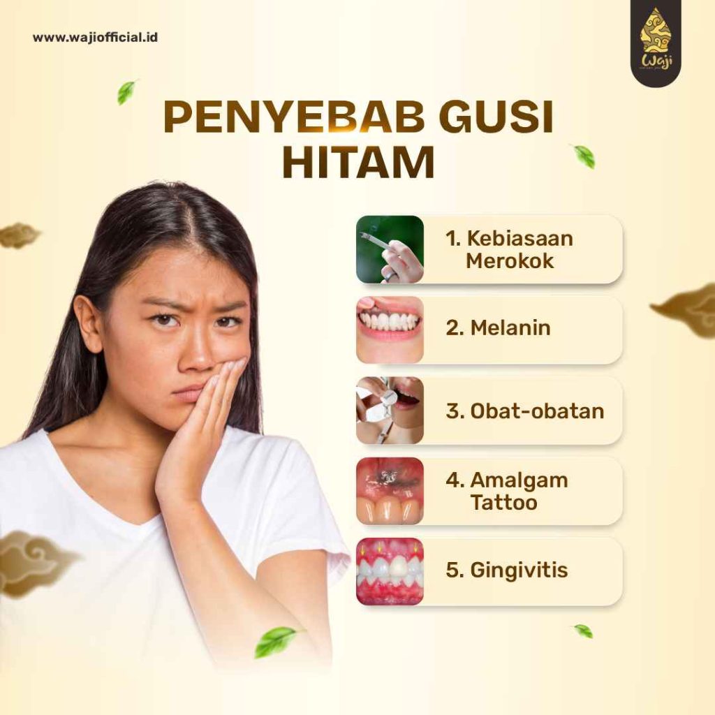 Infografis Penyebab Gusi Hitam 