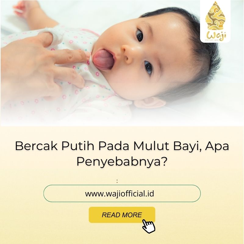 Bercak Putih Pada Mulut Bayi