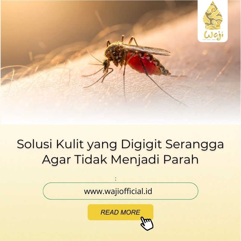 Minyak Esensial Untuk Mengatasi Gigitan Serangga