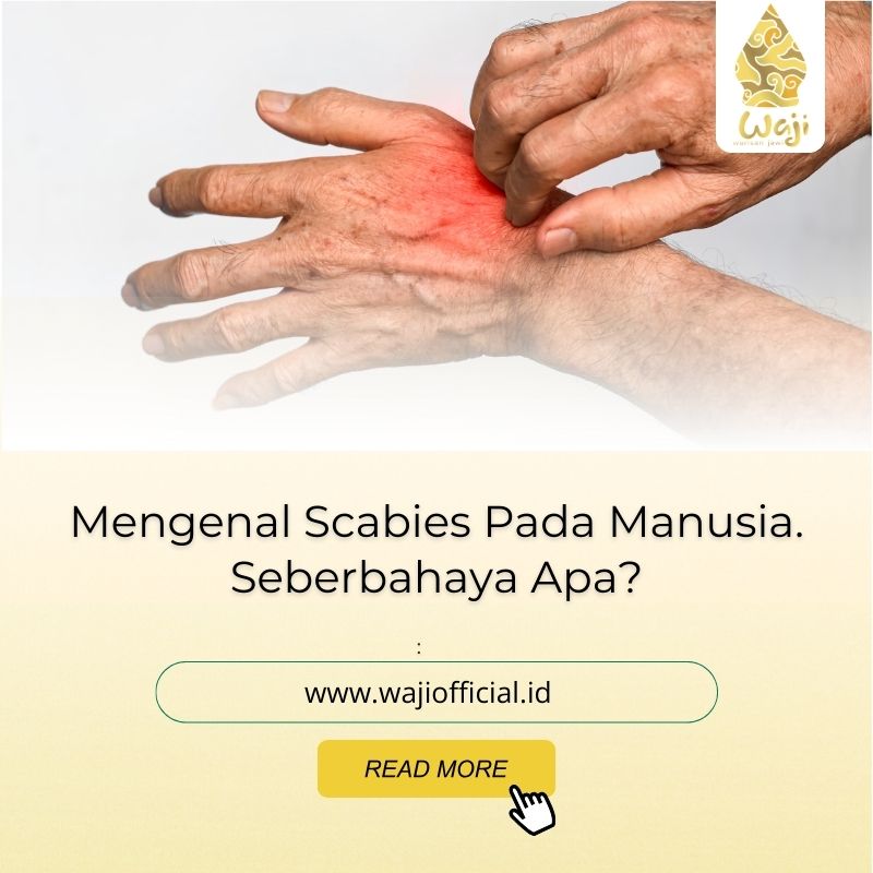 Penyebab Scabies pada Manusia