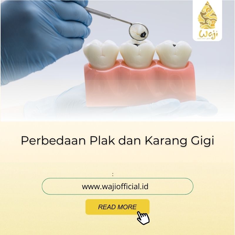 Perbedaan Plak dan Karang Gigi