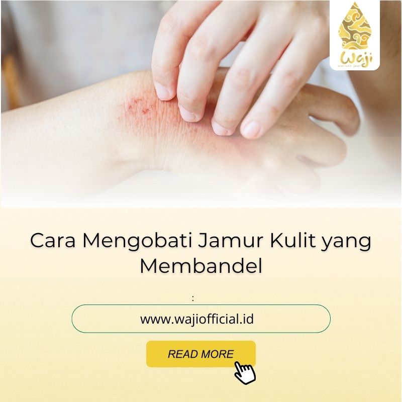 Cara Mengobati Jamur Kulit yang Membandel