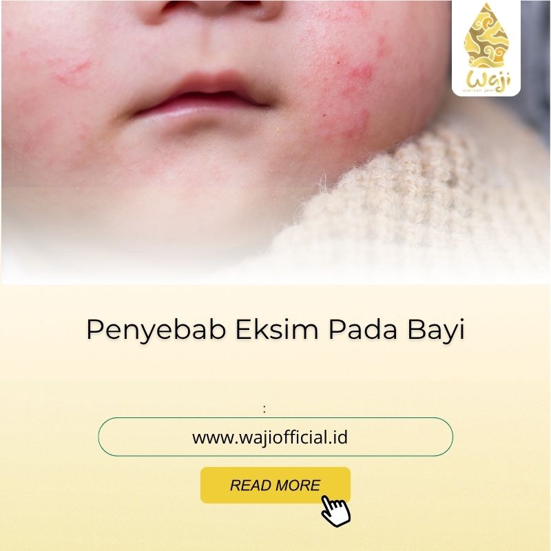 penyebab eksim pada bayi