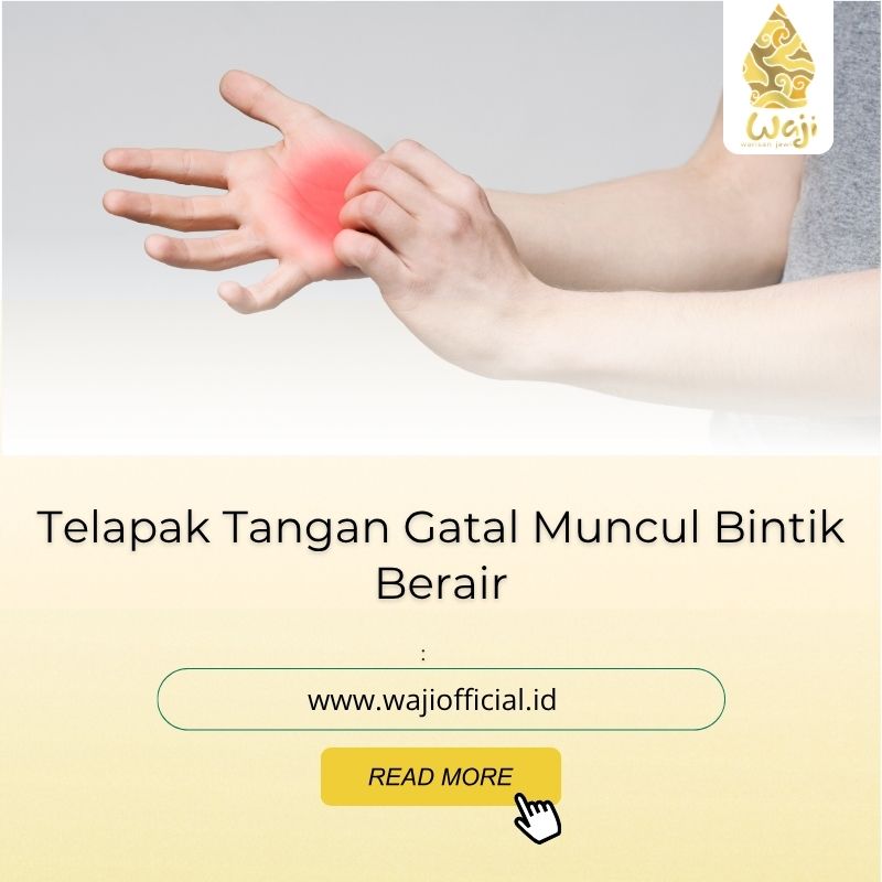 telapak tangan gatal muncul bintik berair