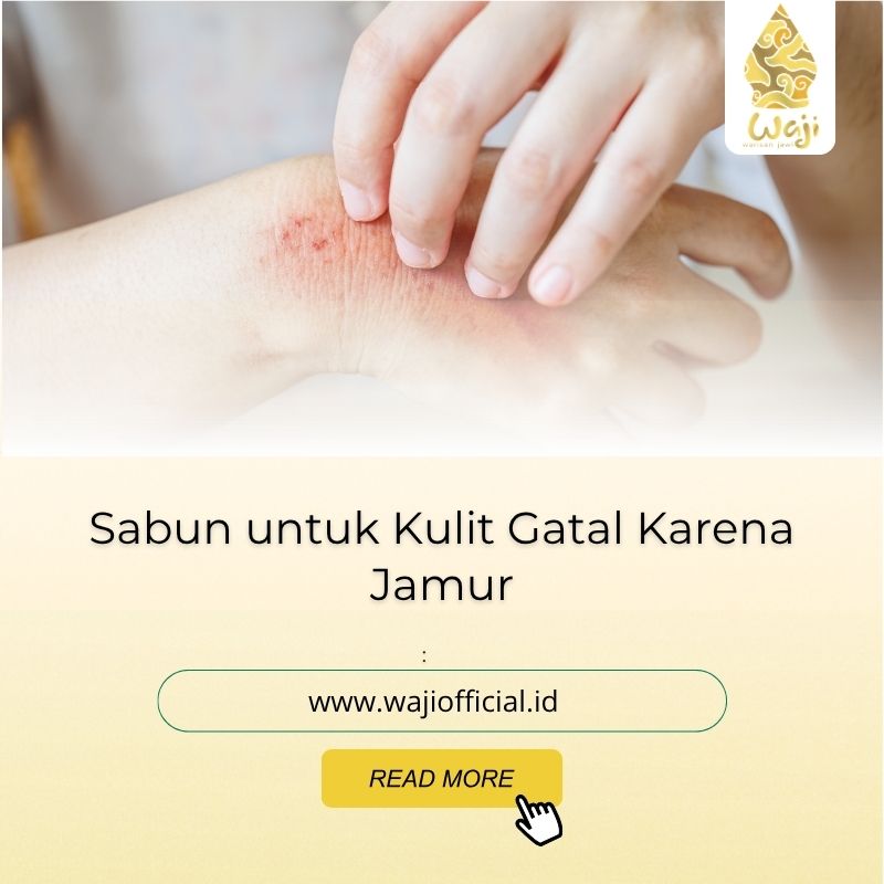 Sabun untuk Kulit Gatal Karena Jamur