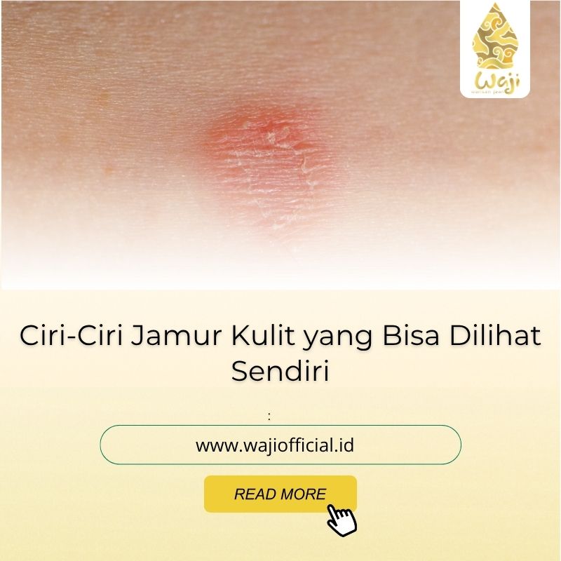 ciri-ciri jamur kulit